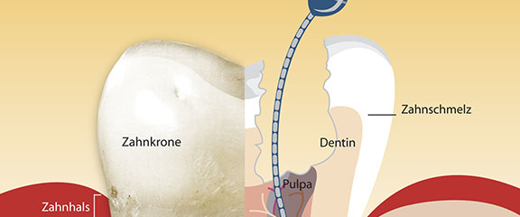 Endodontie